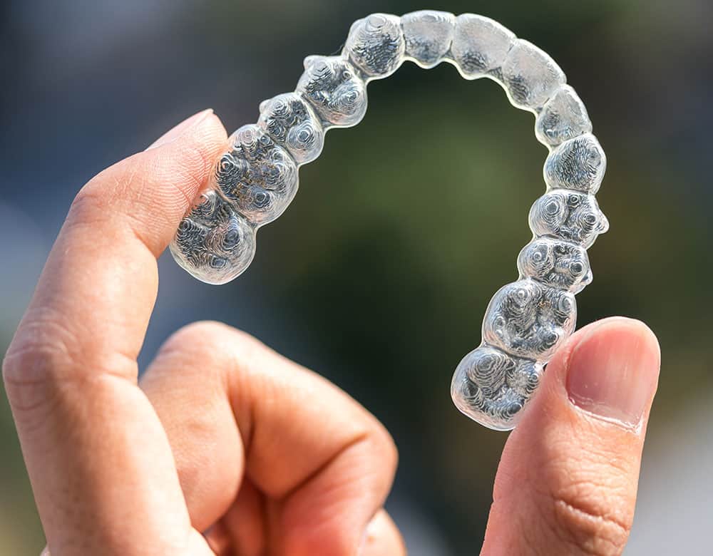 Invisalign Clear Aligners