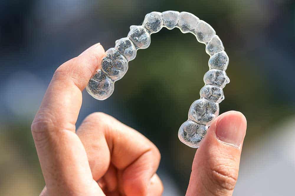 Marion Invisalign Clear Braces